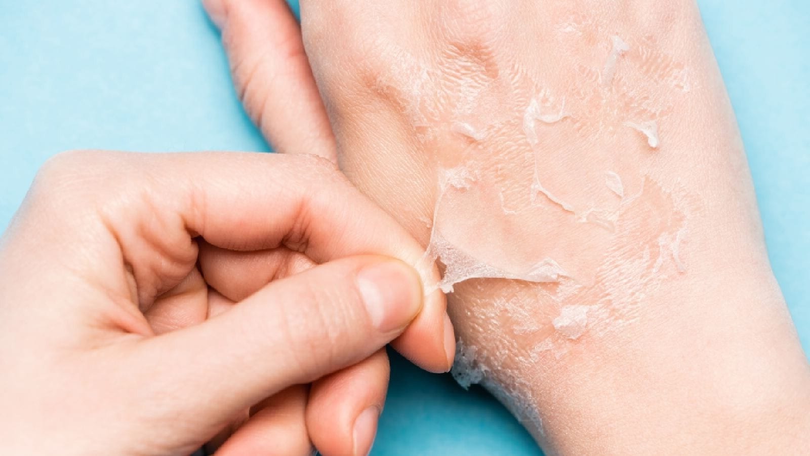 50-facts-about-skin-peeling