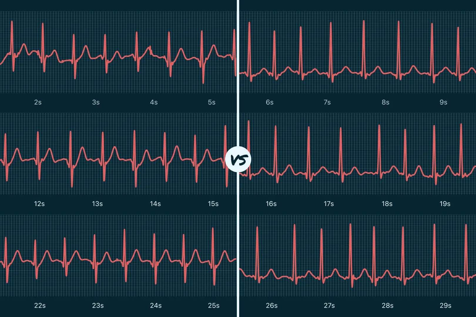 50-facts-about-tachycardia