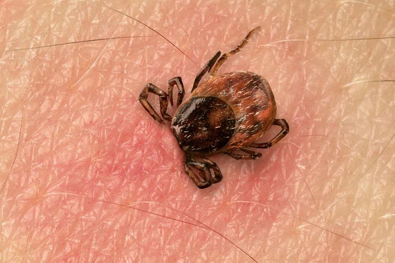 50-facts-about-tick-paralysis