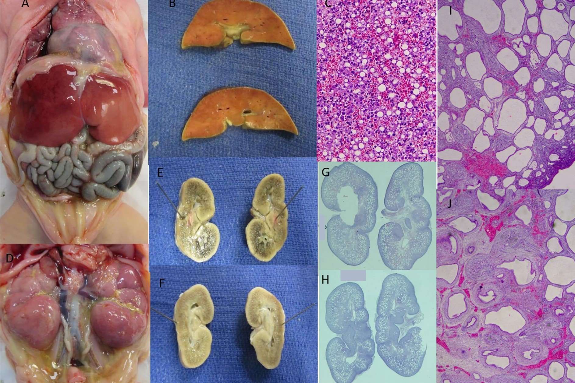 25-facts-about-renal-adysplasia-dominant-type