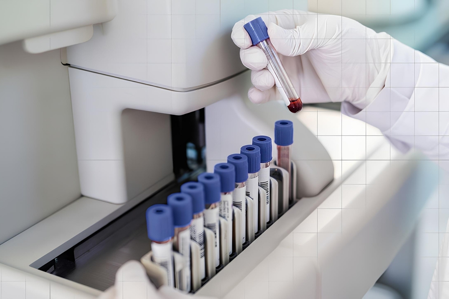 31-facts-about-ferritin