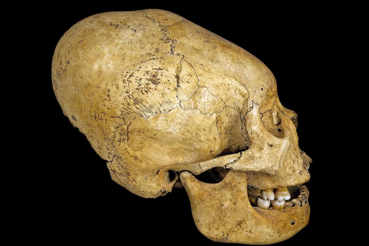 35-facts-about-ancient-roman-elongated-skulls