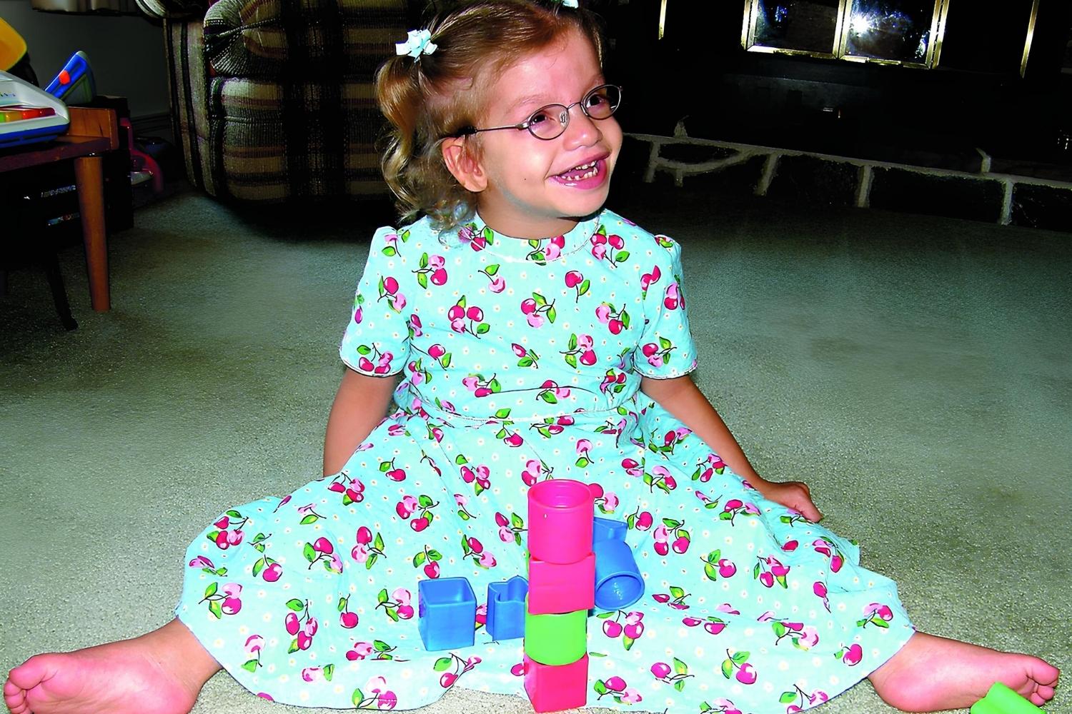 37 Facts About Pretzel Syndrome 