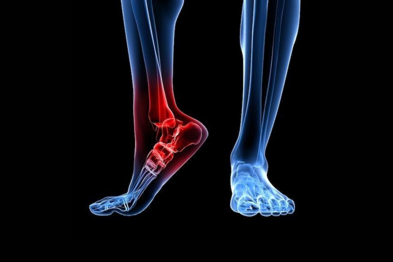 40-facts-about-charcot-disease