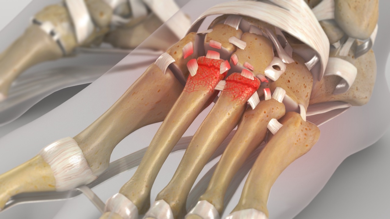 50-facts-about-lisfranc-joint