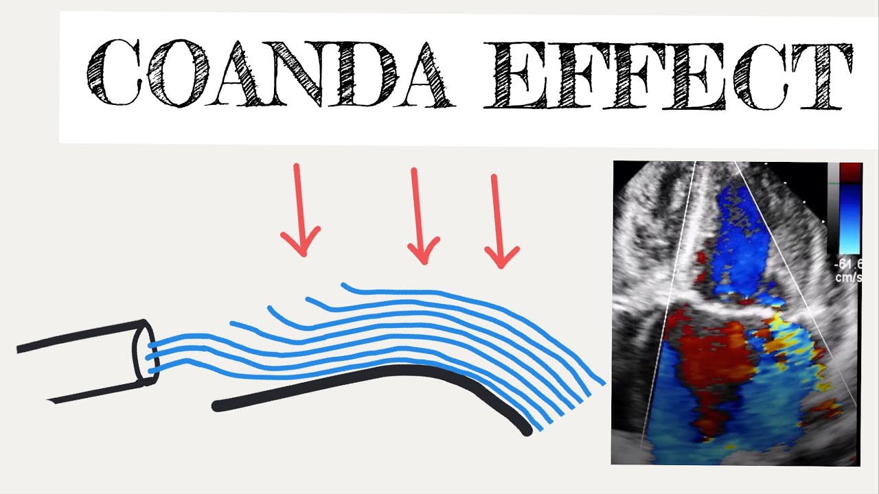 28-facts-about-coanda-effect