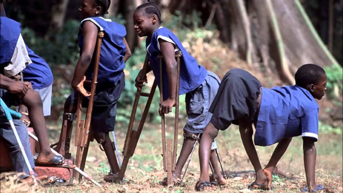 25-eradication-facts-about-polio