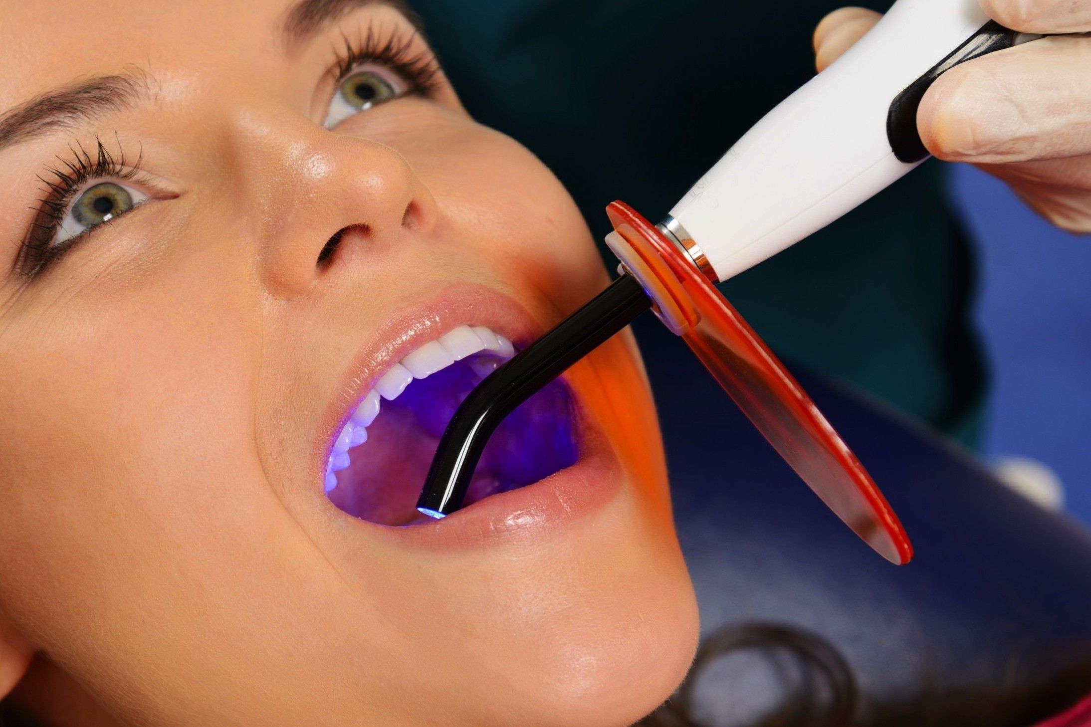 29-facts-about-curing-light