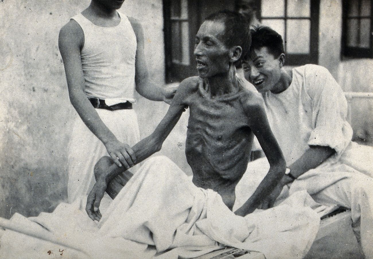 30-facts-about-emaciated