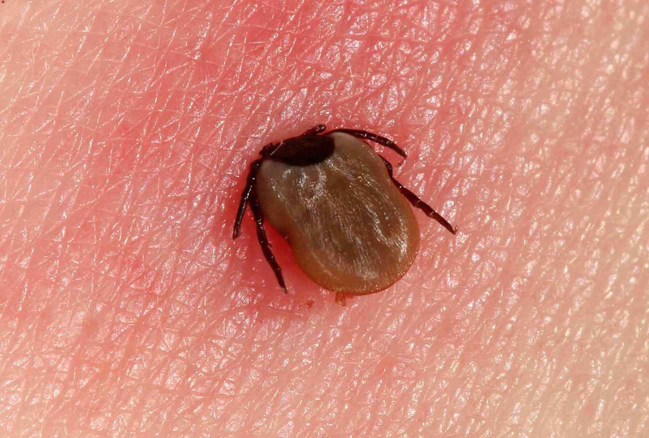35 Facts About Lyme Disease 