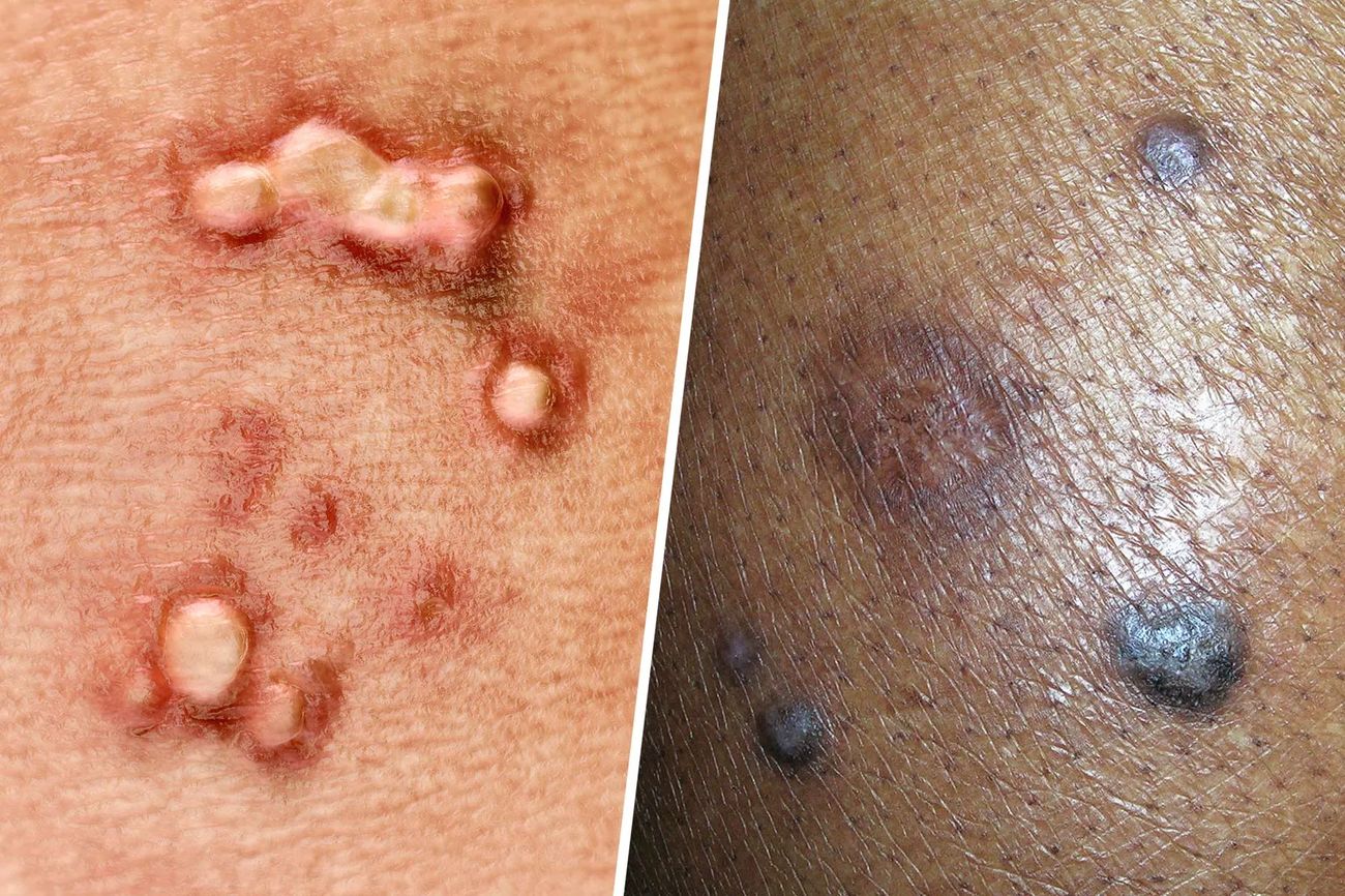 40-facts-about-human-papillomavirus-hpv